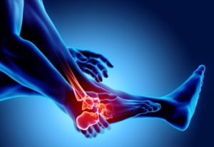 Rheumatoid Arthritis Statistics